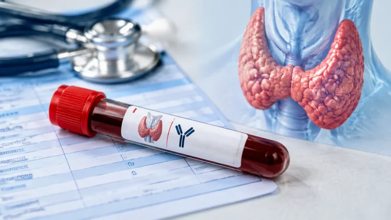 Anticorps anti thyroperoxydase élevé : comprendre son taux TPO