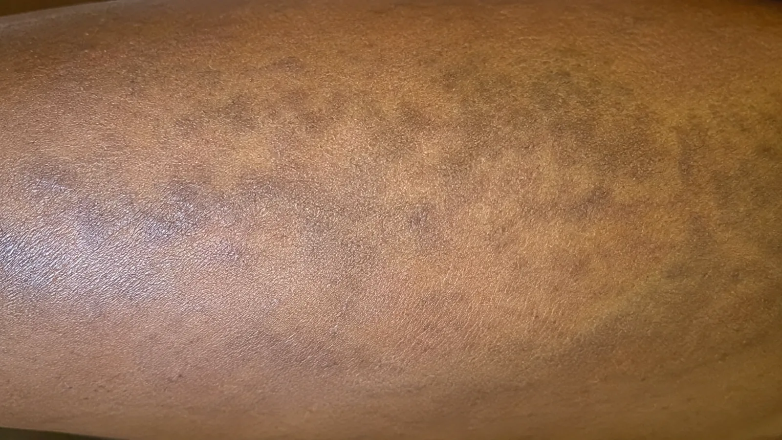 Peau kaki toxique : peut-on la manger sans risque ?