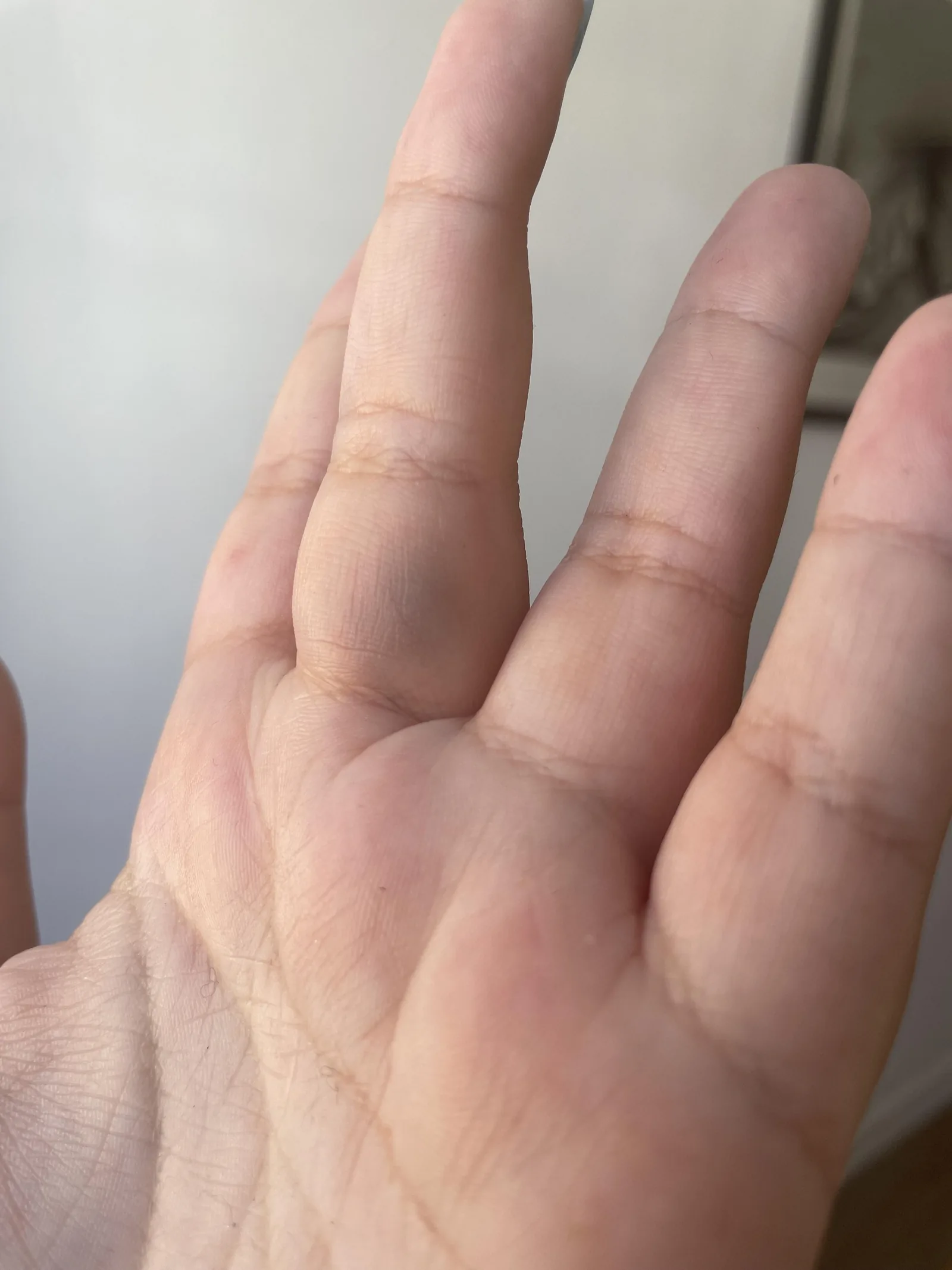 Vaisseaux des doigts qui éclatent : causes et conduite à tenir